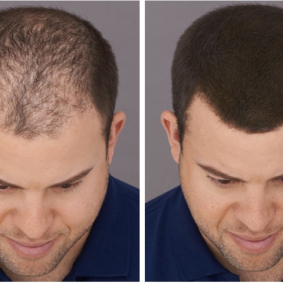 Keratin hair building fibers set of 3 all colors available - Picture 6 of 10